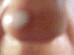 nase
